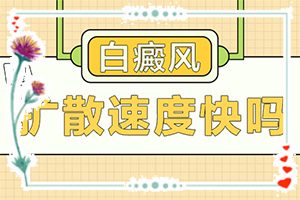白癩風(fēng)可以治療好嗎？有什么土方法嗎（診療白斑這些是關(guān)鍵）