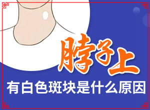 老人腿上長(zhǎng)白斑圖片大[癥狀有哪些不同]白癩風(fēng)圖片早期