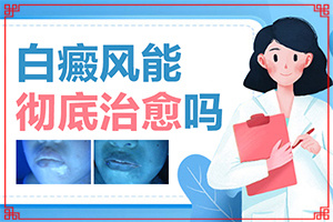 白癩風有哪些的癥狀[得了會有什么癥狀呢]臉上長白殿風怎么辦