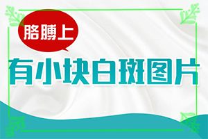 白殿斑早期圖片,一般長(zhǎng)在什么部位呢(常見診斷方式)