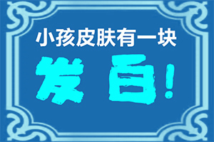 白班病后天性能治好嗎[要點有哪些]小孩子白點癲風能治愈嗎