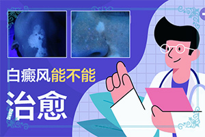 為什么五六歲時臉蛋上有白斑呢,發(fā)生的原因是什么(為什么會出現(xiàn)白癜風)