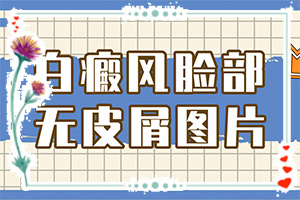 臉上皮膚過敏留下白斑什么原因,什么原因會(huì)誘發(fā)(原因是什么)