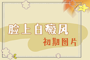 [對(duì)白癜風(fēng)的治療有幫助嗎白點(diǎn)癲風(fēng)治的好嗎