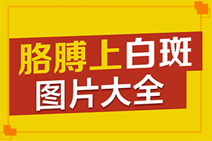 白巔風(fēng)的癥狀,好轉(zhuǎn)癥狀有哪些(表現(xiàn)癥狀是啥)