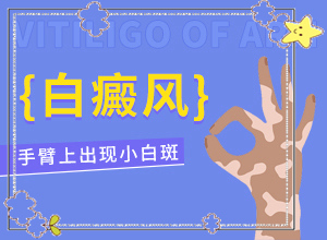 小腿長白班是什么原因,會有哪些癥狀(有一小部分)