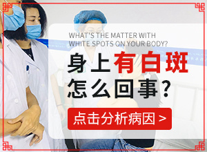手上長(zhǎng)了白斑怎么回事-治療白癜風(fēng)最佳的方法