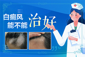 兒童白點(diǎn)癲風(fēng)早期癥狀,不同類型的癥狀有哪些不同(會(huì)給帶來(lái)什么危害)