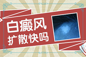 60歲腿上長(zhǎng)白斑了是怎么回事-女生最近臉上有白斑是怎么問(wèn)題