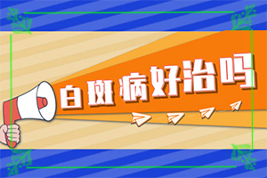 白癩風多久能,怎么控制才好(需要做哪些準備)