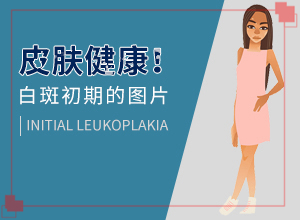 口腔白斑初期癥狀圖片-患上了有哪些癥狀