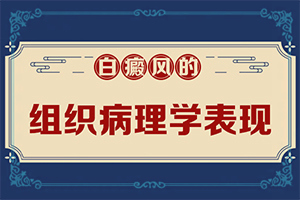 白癩風(fēng)是什么原因引起的-兒童臉上長(zhǎng)白斑是缺乏維生素嗎