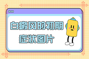 腳小腿長白斑是什么原因[都有哪些表現(xiàn)]白癲風早期圖片