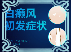 孩子夏天臉上有白斑是什么原因,發(fā)病的原因有哪些(什么原因會誘導白斑)