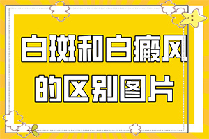 白的治療方法是什么,真的能盡快治療好嗎(大了點怎么辦)