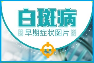 「輕度白癩風(fēng)癥狀」有效的預(yù)防的措施有哪些?