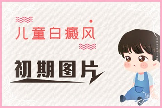 青少年白癩風頻發(fā)，這些原因你都了解嗎