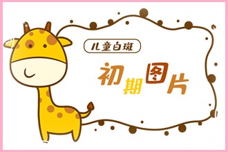 這些因素影響白點(diǎn)風(fēng)看好需要