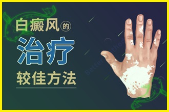 白顛風(fēng)怎么治療好的快-檢查病因、制定方法、防護(hù)三步走