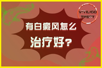 白點(diǎn)風(fēng)怎么治療好的快-有效方法(藥物還是光療)