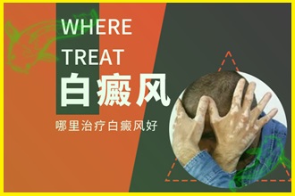 白癲風(fēng)的早期癥狀圖片避免擴(kuò)散，這些措施要一一執(zhí)行