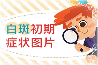 白點風能嗎-病情反復發(fā)作-科學醫(yī)治才是正途