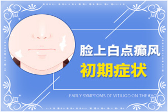 福泉市自癜風(fēng)多久能-縮短醫(yī)治周期措施有哪些