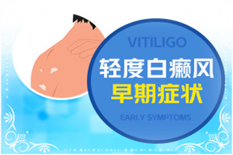 白顛瘋病初期癥狀醫(yī)治費(fèi)用是多少-哪些因素影響費(fèi)用