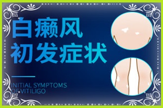 兒童白點(diǎn)癲風(fēng)是什么原因引起的-這幾點(diǎn)病因是常見的