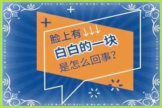手指上有白色的小塊白點癲風(fēng)圖片-防止擴散這些要做好