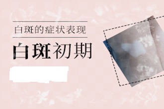 遵義身上有[白癜風(fēng)]白斑圖片居然擴散了-什么原因引發(fā)的呢