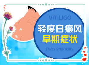 小孩手臂白班,有哪些癥狀表明出現(xiàn)嚴(yán)重情況呢(有什么區(qū)別呢)