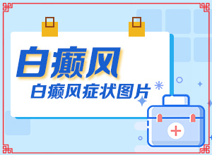 白癩風(fēng)是什么形狀的,有什么特點(diǎn)(主要臨床癥狀是什么)