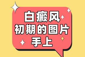 [一對(duì)一問診]在治療手臂白癜風(fēng)的時(shí)候要注意一些什么-白癜風(fēng)治療注意事項(xiàng)提點(diǎn)