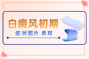 白點(diǎn)癲風(fēng)的初期如何冶[如何進(jìn)行治療]兒童白顛瘋病可以治愈嗎