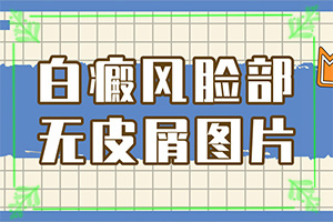 白班用什么藥涂[如何輔助治療呢]兒童白點(diǎn)癲風(fēng)可以治好嗎