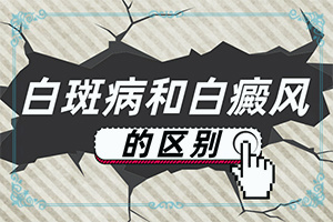 白癩風有什么癥狀嗎?,都有哪些癥狀表現(xiàn)呢(表現(xiàn)癥狀是啥)