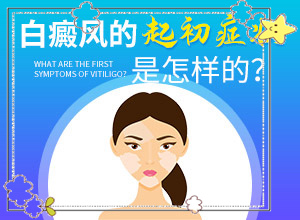 白點癲風如何治療了[容易進入的治療誤區(qū)]手上一年多白斑怎么治呢