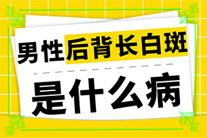 白班的治療方法,診治的方法有哪些(如何能讓白癜風(fēng)早日治療好)