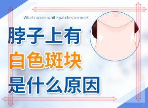 臉上白斑是什么原因，如何解決,什么原因會(huì)誘導(dǎo)白斑(常見原因)