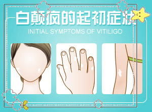 白癲風(fēng)可以嗎,為什么要早治療(診治的方法有哪些)
