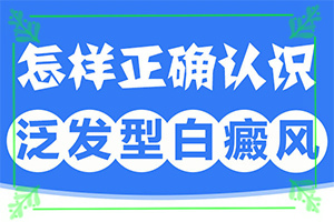 白斑點(如何有效護(hù)理好呢)-白斑長什么樣圖片