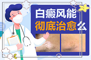 肛門白斑有什么藥可以治[常見癥狀是什么樣的]白顛初期癥狀