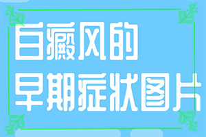 白點(diǎn)癲風(fēng)的圖片早期[如何診斷正確的呢]胳膊起白班怎么回事