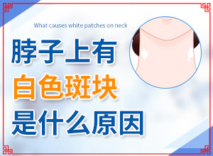 白點(diǎn)癲風(fēng)用什么藥膏治最快-這樣治療是否有效