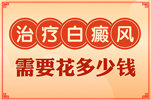 白點(diǎn)癲風(fēng)的圖片早期,怎么檢查呢(白斑剛出現(xiàn)是啥樣)