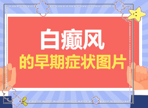 白癜風常見誘因有哪些-脖子上長一塊白斑是什么引起的