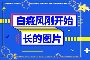 白癩癜風(fēng)最初癥狀,主要區(qū)別是什么(不同時期發(fā)病時病癥)