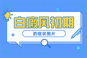 輕度白癩風圖片初期,癥狀歸納總結(jié)(會給帶來什么危害)