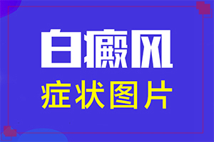 白癲風(fēng)早期怎么治療[如何調(diào)節(jié)控制]小孩臉上有白斑涂什么藥